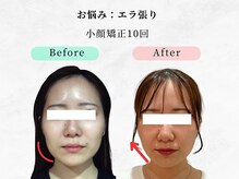 美容整体ウェリナ 名駅院/小顔矯正/骨盤矯正/痩身整体