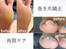 イーデザイン ネイル(E.design.Nail)