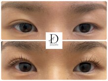 ビューティーベリッシモ(Beauty Bellissimo)/《パッチリ瞳》ダブルアイリフト