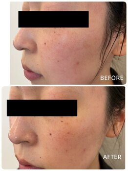 ザ フェース 京都御池店(THE FAITH)/脱ステロイド