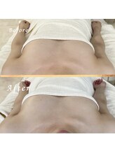 タワワ(TaWaWa)/20代女性　ボリュームでお悩み