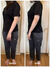 癒楽整体院 ゆうらく分院 練馬春日町/before after(腰のねじれ)