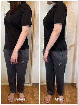 癒楽整体院 ゆうらく分院 練馬春日町/before after(腰のねじれ)