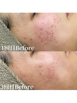 アンバー(amber)/諦めない肌へ