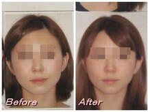 ドクター ヴィーナス/歪み改善の症例