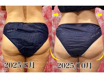 ラブ美長寿 沖縄本店(Lab)/【美肌痩身】下半身痩身コース