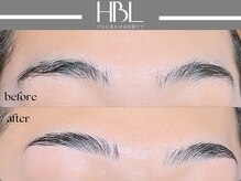 アポロ(Apollo)/ハリウッドブロウリフト