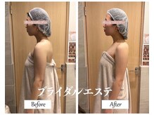 リノ(Lino)/ブライダルエステ