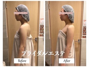 リノ(Lino)/ブライダルエステ