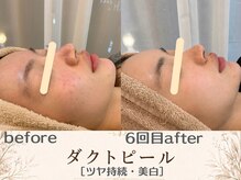 エスポワール(espoir)/before・after