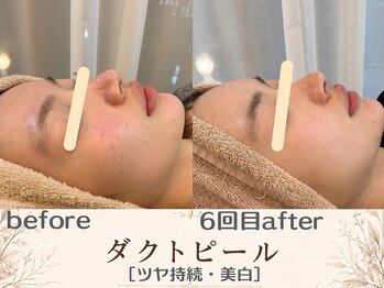 エスポワール(espoir)/before・after