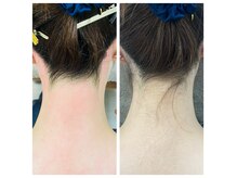 リネン(Lien)の雰囲気（ブラジリアンワックスやボディワックスも人気です！）
