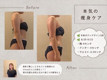 ヴィマ 北堀江(Vima)の写真/【下腹ぽっこりや浮き輪肉を撃退！】歴19年のプロ技術で理想の美くびれをメイク☆【四ツ橋/痩身】
