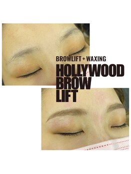 モル(Molu)/ハリウッドブロウリフト