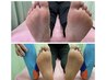 【体の歪み/左右バランスの違和感に】足から変えるオーダーメイドご相談¥1000