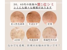 武蔵小杉リンパサロン かおりの部屋/光フェイシャルでシミレスな肌に
