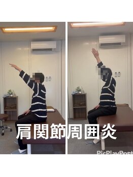 カワル整体 長嶺院/肩関節周囲