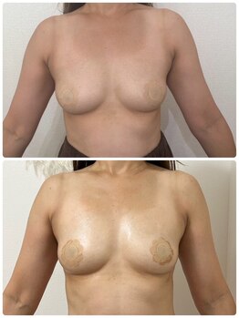 エルミナ.(elmina.)/カップ数UP！結果重視サロン！