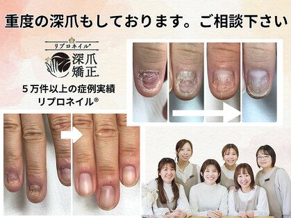 エルナの写真