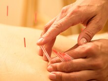 アニージャ バイ ビアッジオ(anilla by Viaggio)/東洋医学に基づく施術
