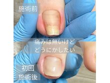 ニコットネイル(nicotto nail)の雰囲気（爪のお悩みご相談下さい。）