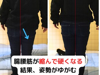 よしかわ整体院/重心のズレをなおしてしびれ改善