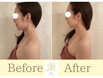 リコ(Rico)/横幅スッキリしEラインも美しく