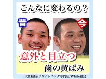 ホワイトニングサロン ホワイト(WHITE)/セルフホワイトニング/大阪/福島