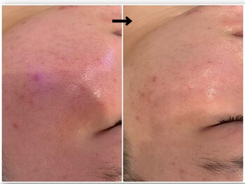 エフェクト 塚口店(effect)/Before After