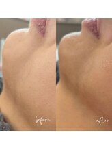 ノン(Non.)/ヌクレールフェイシャルワックス