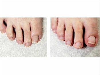 ビオトーププラス 浦和店(bio tope +)/フットケア[浦和/パラジェル]