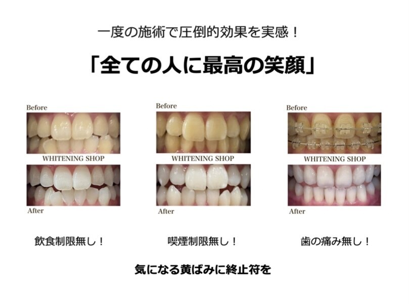 ホワイトニングショップ 焼津店｜ホットペッパービューティー