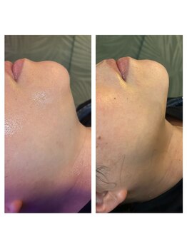 サロン ド オージャス(salon de ojas)/ビフォアフ顔