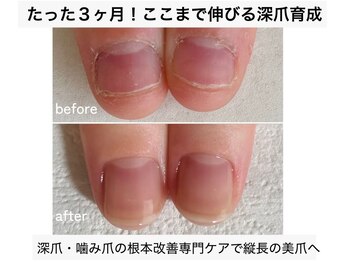シーネイル(C Nail)