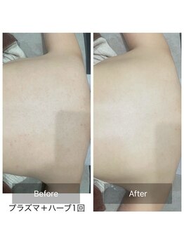 リバース 大阪店(Rebirth)/メイクしないでも自信が持てる!