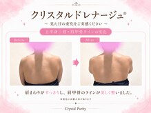 クリスタルプュリティ(Crystal Purity)の雰囲気（肩甲骨すっきり、背中美人へクリスタルドレナージュ）