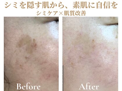 コトハ(cottha)の写真
