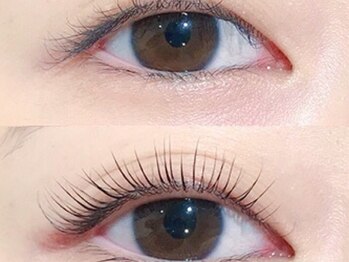 ビューティーサロン ランジュ/アップフォースリフト