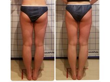 フェリシテ(Felicite)/ビフォーアフター