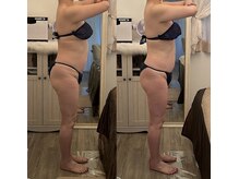 サロン ド ミニョン(salon de mignon)/40歳から始めるエステ♪