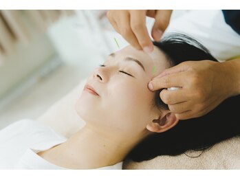 さかうえ接骨院の写真/【お顔がぐんぐん上がる・たるみ改善◎】重力で垂れ下がるお顔の筋肉を美容鍼でアゲアゲに！リフトアップ◎