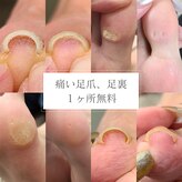 シーナ(Siina)