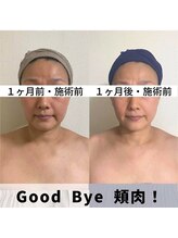 お顔の研究所/ビフォーアフター写真♪