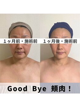 お顔の研究所/ビフォーアフター写真♪