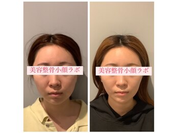美容整骨小顔ラボ/小顔矯正×マシン