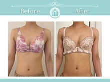 美人バスト つくば店/【バストアップ/育乳 症例】