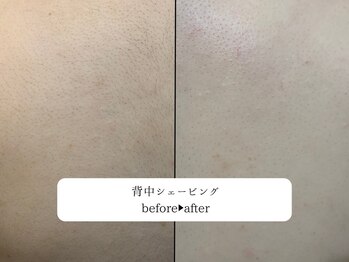 レオロ(leolo)/ボディシェービング