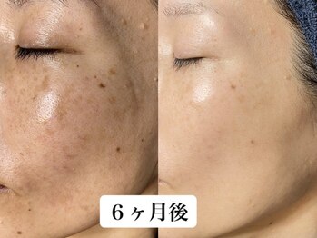 ソリッジ肌管理室