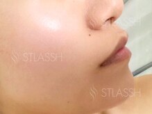 ストラッシュ 名古屋駅前店(STLASSH)