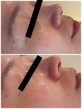 エイシスグロウ(asis glow.)/韓国肌管理